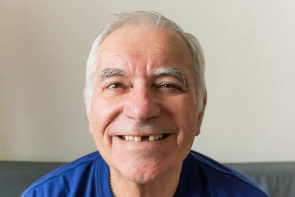 Tooth Replacement: Dentures Or Dental Implants?